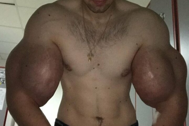 36