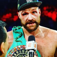 Tysonas Fury | Instagram.com nuotr 41