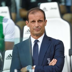 „Juventus“ - „Lazio“ rungtynių akimirka  | Scanpix nuotr. 1