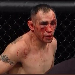 Tony Fergusonas prieš Justiną Gaethje | „X“ nuotr. 2