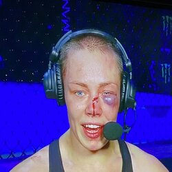 Rose Namajunas | „X“ nuotr. 5