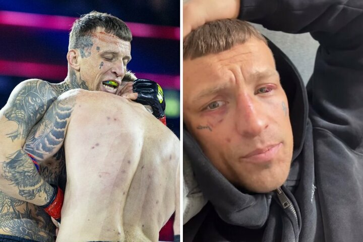 Arnoldas Misiūnas po kovos su Buinicku: „Daugiau aš negaliu taip kovoti, turiu susitvarkyti šitą klausimą, nes tai yra mirtis mano karjerai“