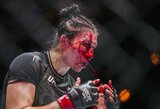 „UFC 306“ turnyre I.Aldanai atsivėrė siaubinga kirtinė žaizda: gydytojas pasidalino šiurpą keliančiu įrašu