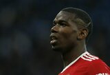 P.Pogba prireiks operacijos, futbolininkas iškrito bent dviem mėnesiams