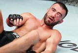 Tik stiprių nervų žmonėms: į rekordinį kiekį nokdaunų siųsto UFC kovotojo akis – tarsi balionas