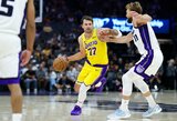 „Lakers“ treneris išskyrė ryškiausią Dončičiaus vasaros pasikeitimą
