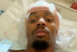 UFC kovotojas atsidūrė ligoninėje: „Vos mirtinai nenukraujavau, nes greitosios pagalbos laukiau 45 minutes“