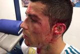 „Real“ pasidalino sukrečiančiu C.Ronaldo traumos vaizdo įrašu: galėjo baigtis labai blogai