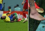 Brazilijos rinktinės gydytojas prakalbo apie Neymaro traumos rimtumą: „Dėl smūgio keliu, gydymą pradėjome jau ant suolo“