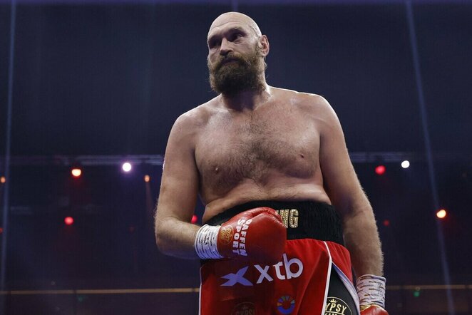 Tysonas Fury | Scanpix nuotr.