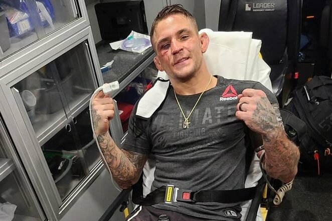 Dustinas Poirier | Scanpix nuotr.