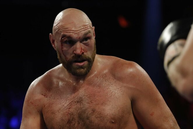 Tysonas Fury | Scanpix nuotr.