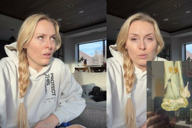 Lindsey Vonn | Instagram.com nuotr