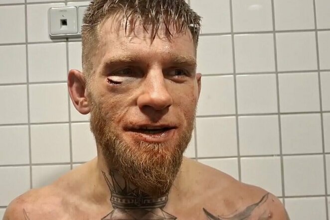 Oskaras Buinickas | „Stop“ kadras