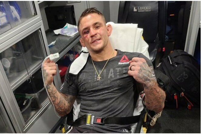 Dustinas Poirier | „Twitter“ nuotr.