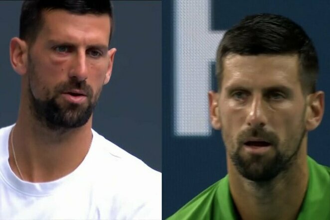 Novakas Djokovičius | „Stop“ kadras