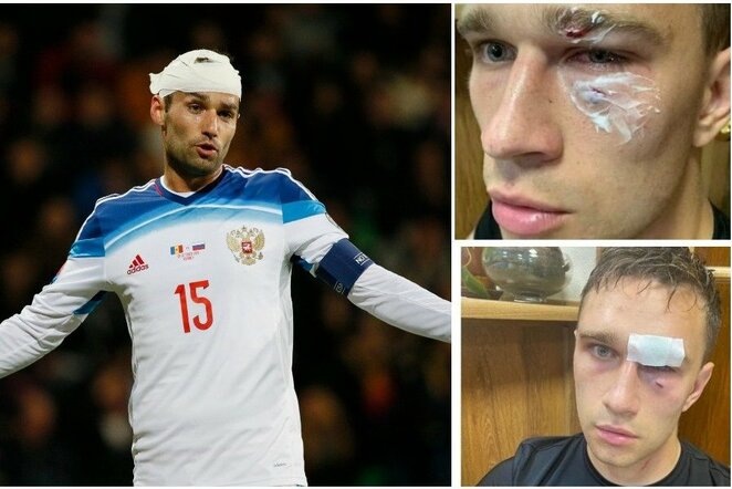 Romanas Širokovas sumušė teisėją | „Scanpix“ ir instagram.com nuotr.