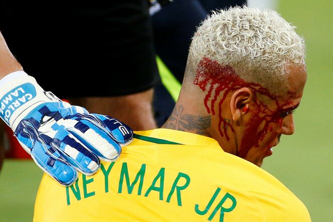 Neymaras | Scanpix nuotr.