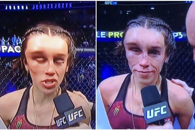 Joanna Jedrzejczyk | „Twitter“ nuotr.
