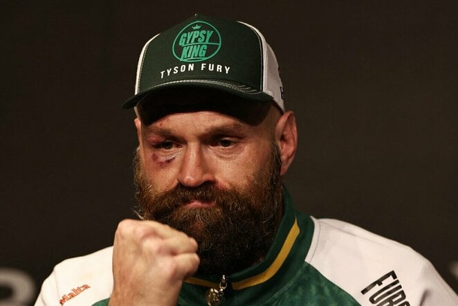 Tysonas Fury | Scanpix nuotr.