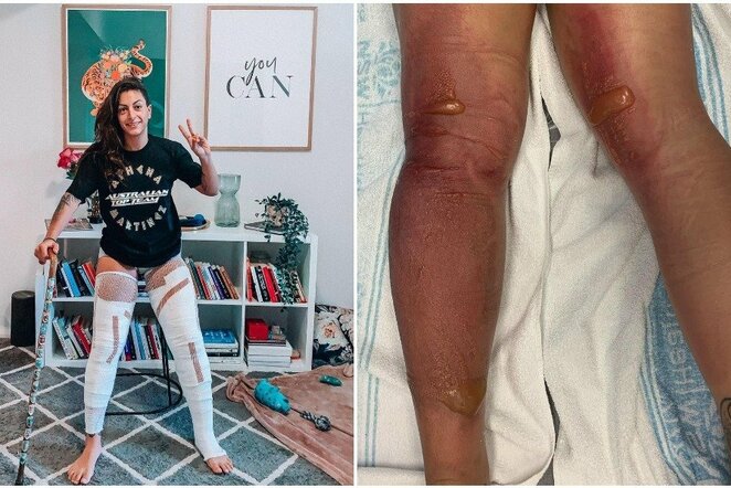 Athena Martinez | Instagram.com nuotr