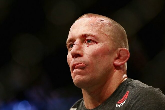 Georgesas St-Pierre'as prieš Michaelą Bispingą | Scanpix nuotr.