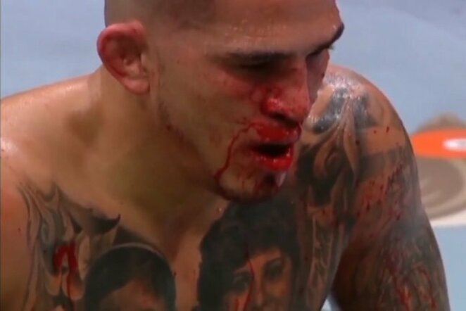 Anthony Pettis | Youtube.com nuotr.