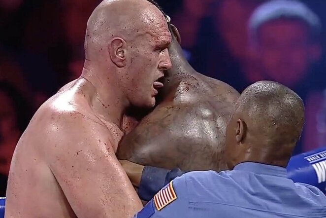 Tysonas Fury ir Deontay Wilderis | „Stop“ kadras