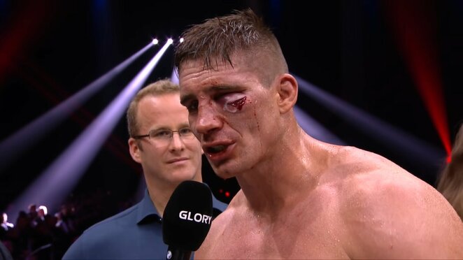 Rico Verhoevenas | „Stop“ kadras Rico Verhoevenas | „Stop“ kadras