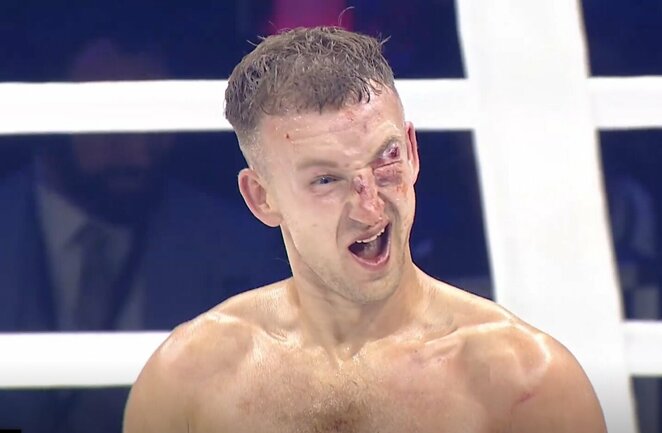 Martynas Danius | „Stop“ kadras Martynas Danius | „Stop“ kadras