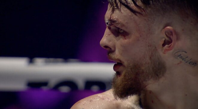 Dominykas Dirkstys | „Stop“ kadras Dominykas Dirkstys | „Stop“ kadras