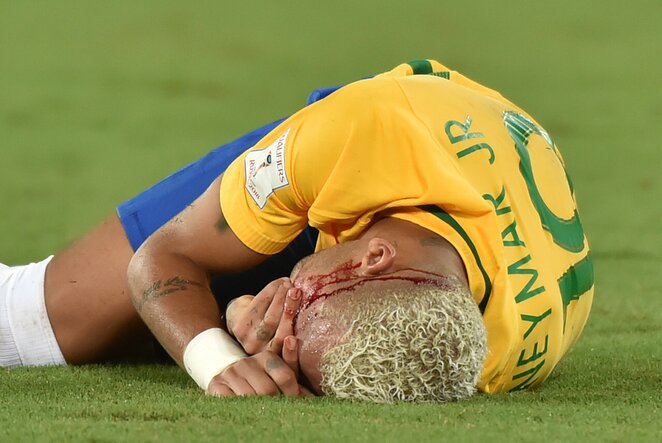Neymaras | Scanpix nuotr.