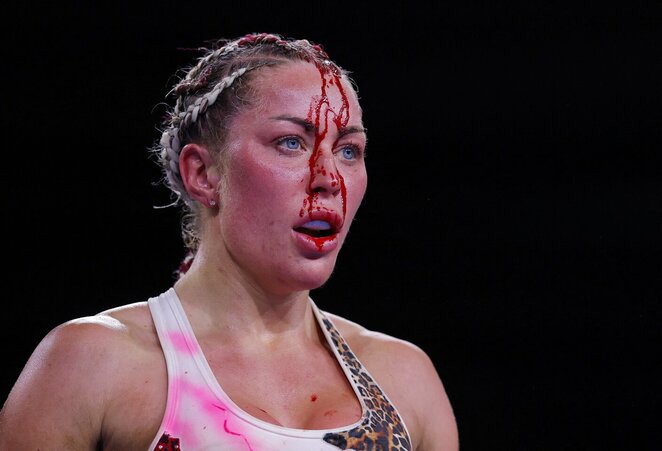 Ebonie Cotton | Scanpix nuotr.