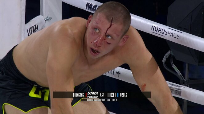 Dominykas Dirkstys | „Stop“ kadras